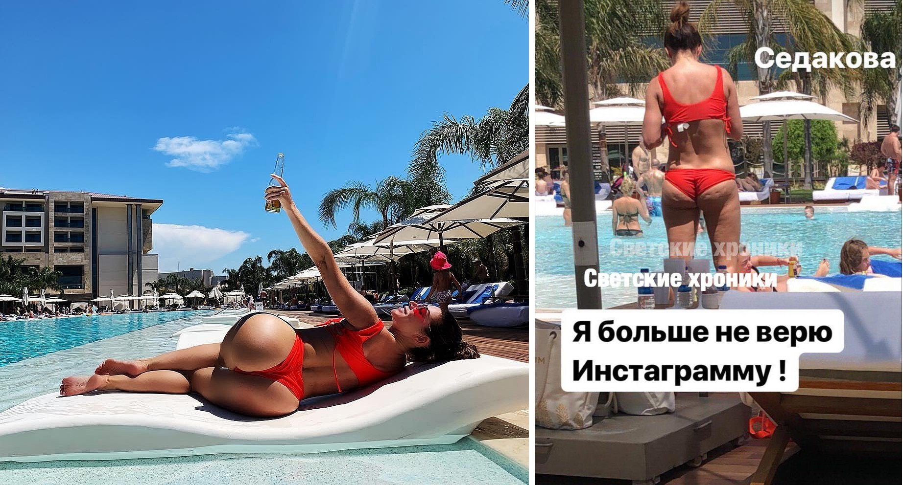 Скандальные фотографии Анны Седаковой без трусиков
