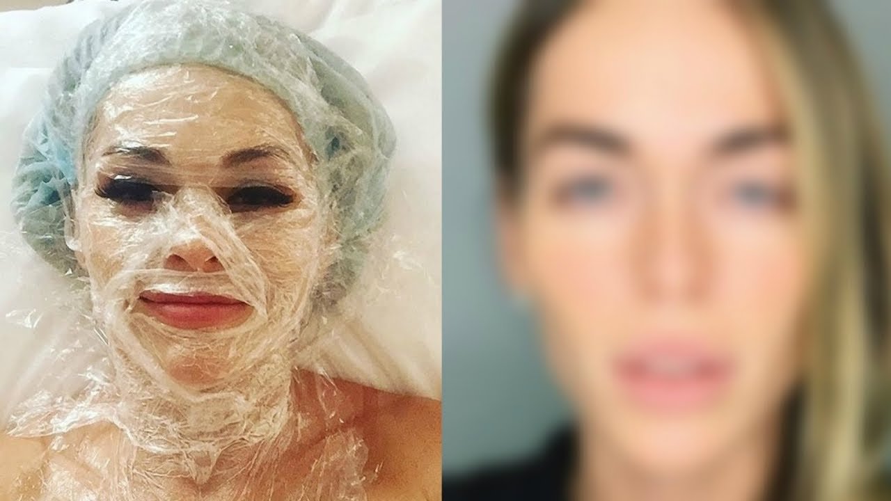 Хилькевич анна до и после операции фото