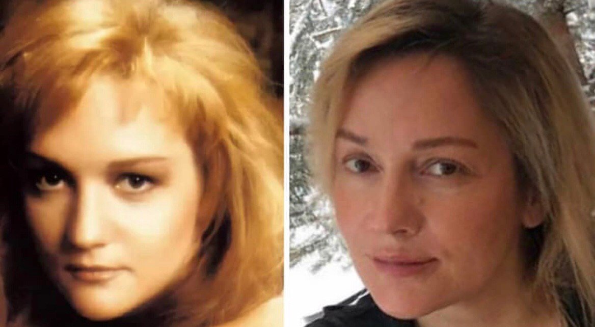 Татьяна буланова до и после пластики сравнение фото