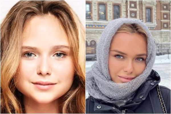 Стефания до и после пластики губ Фотоколлаж: Владтайм